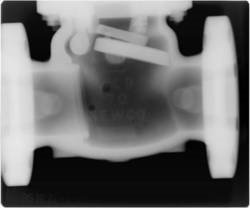radiography-with-x-ray
